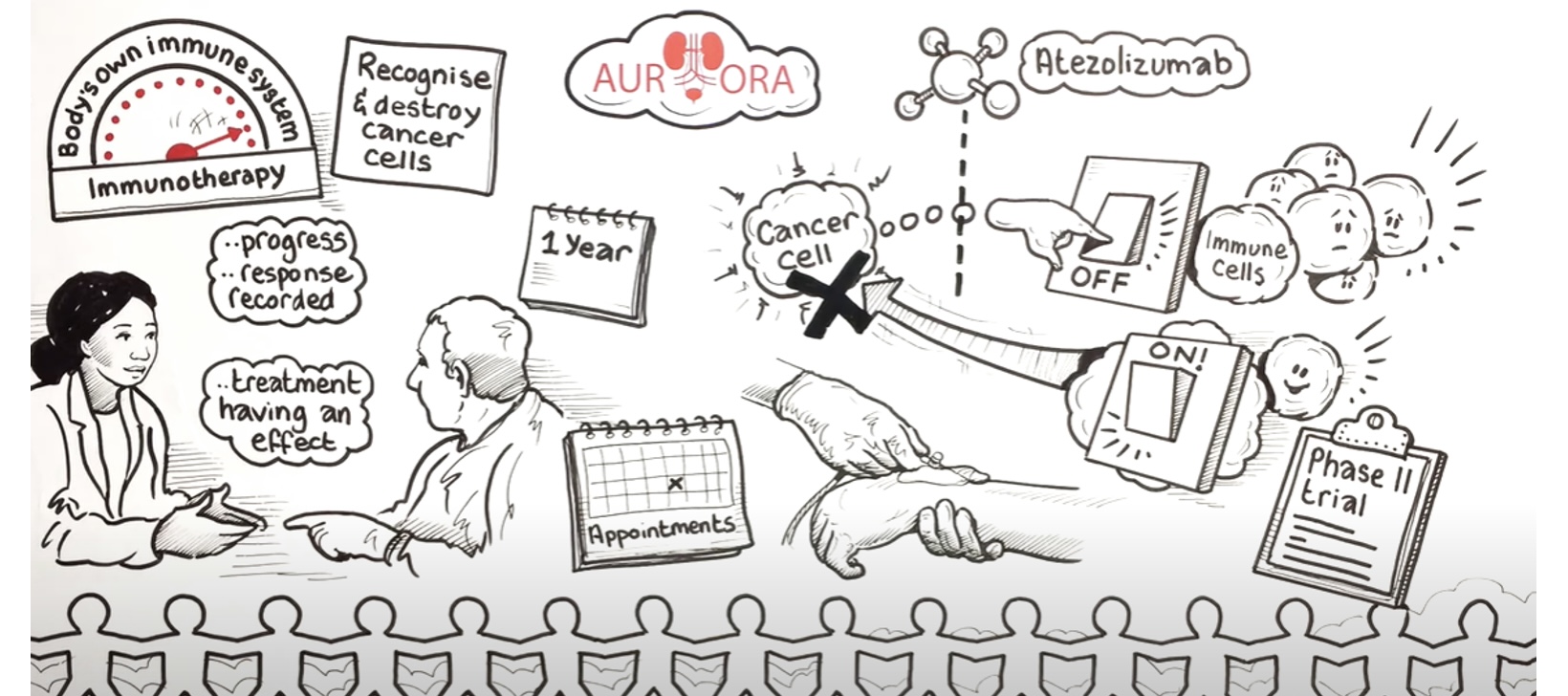 AURORA Study: Immunotherapy’s Role in Treating Urinary Tract Squamous Cell Carcinoma