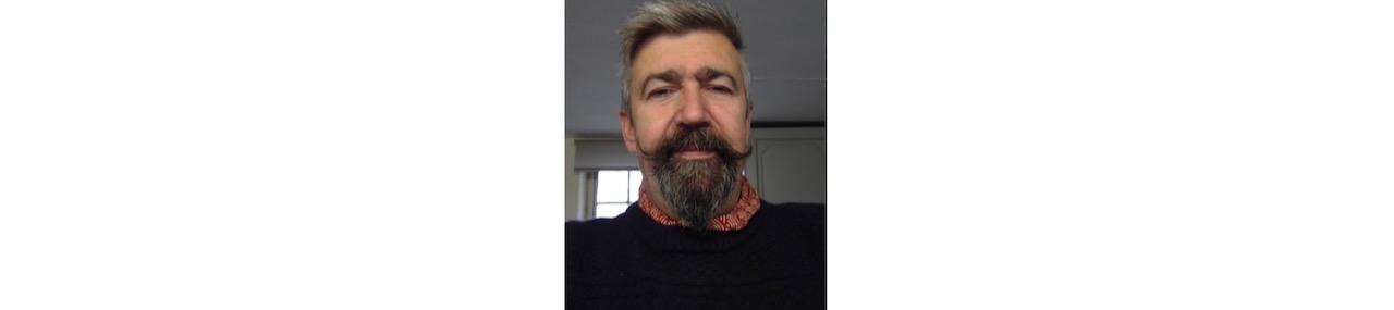 Darron, radical cystectomy, and choosing life over fear