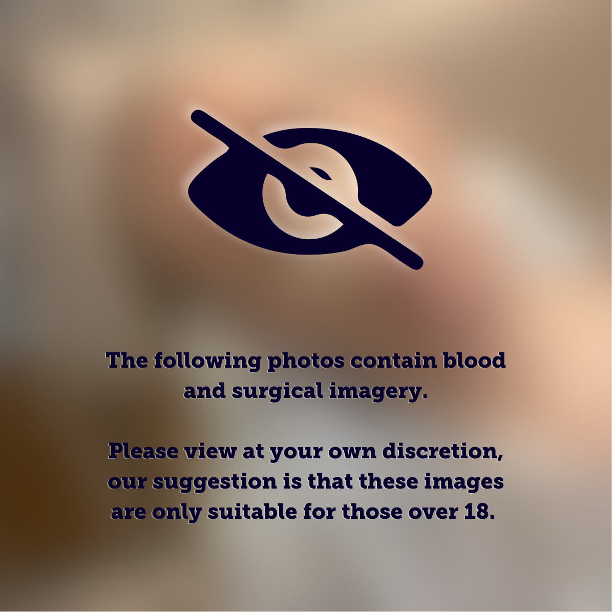 Warning: the following images contain blood and surgical imagery. Please view at your own discretion.